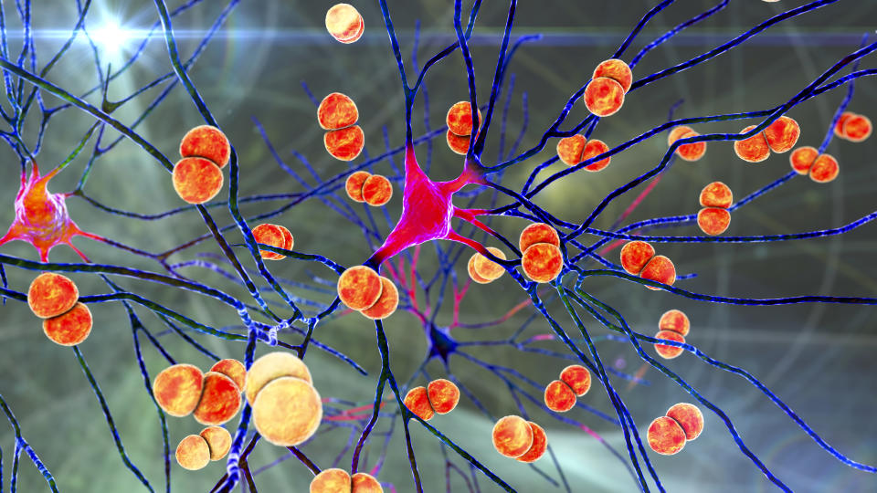 Bacterial brain infection. Conceptual computer illustration showing Streptococcus pneumoniae bacteria, one of the main causes of bacterial meningitis and meningoencephalitis, infecting brain cells.