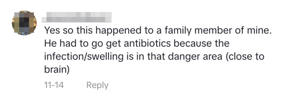 "Yes, so this happened to a family member of mine. He had to go get antibiotics because the infection/swelling is in that danger area (close to the brain)"