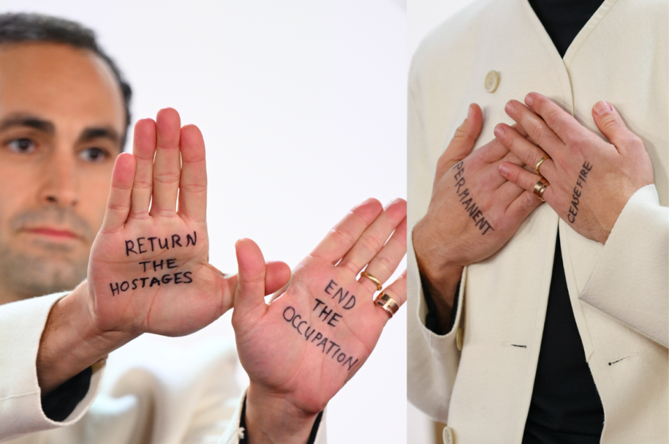 Khalid Abdalla holds up his hands with two messages reading 