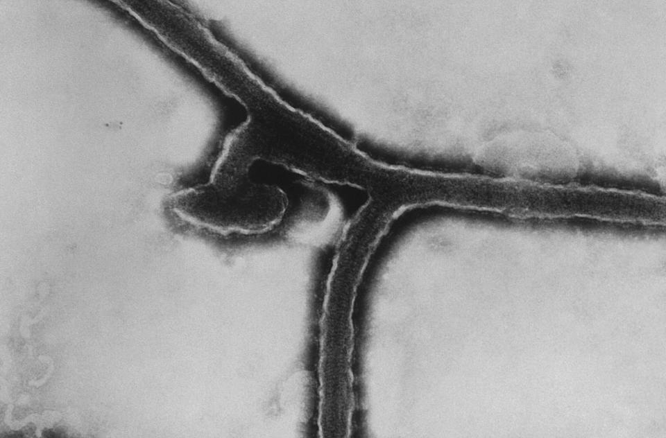 Black-and-white microscopic image of virus.