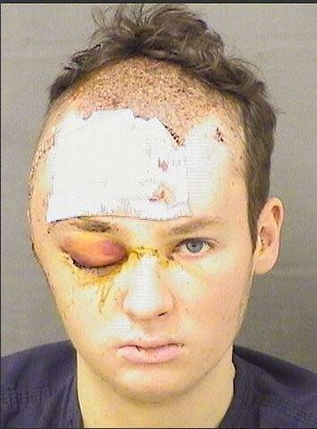 Tzvi Allswang's mug shot. He had been shot in the head by a PBSO deputy as he held a knife to his therapist's throat.