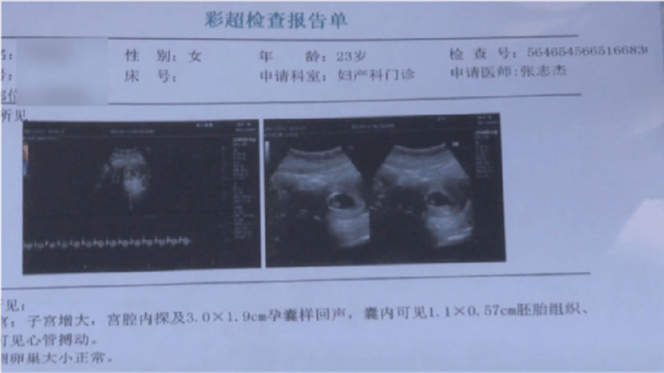 女子術後2天出現噁心想吐，就醫檢查後發現懷孕，她認為美容機構並未告知有明顯疏失而提告求償。（圖／翻攝自浙江交通之聲）