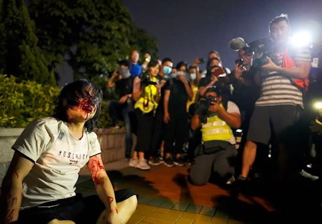 A pro-Beijing man sits bleeding on a road after he was hit by protesters for waving a Chinese national flag during a rally at Tamar park in Hong Kong, Saturday, Sept. 28, 2019. Thousands of people gathered Saturday for a rally in downtown Hong Kong, belting out songs, speeches and slogans to mark the fifth anniversary of the start of the 2014 Umbrella protest movement that called for democratic reforms in the semiautonomous Chinese territory. (AP Photo/Vincent Yu)