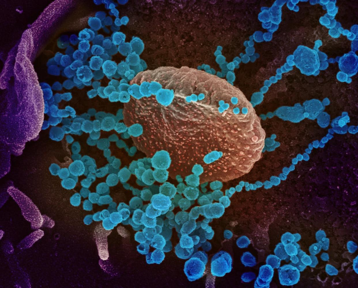 <span class="caption">This scanning electron microscope image shows SARS-CoV-2 (round blue objects) emerging from the surface of cells cultured in the lab. </span> <span class="attribution"><a class="link " href="https://www.flickr.com/photos/nihgov/49565158953/in/album-72157713108522106/" rel="nofollow noopener" target="_blank" data-ylk="slk:NIAID-RML;elm:context_link;itc:0;sec:content-canvas"> NIAID-RML</a></span>