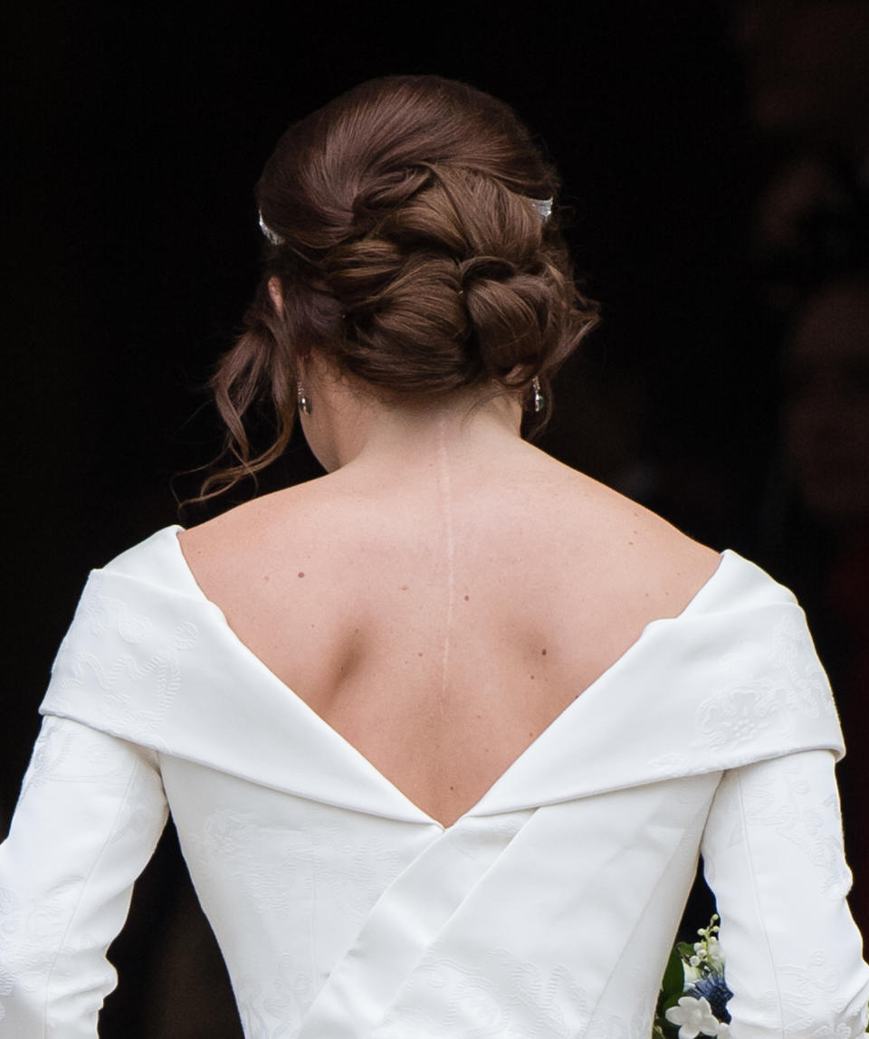 <p>Princess Eugenie proudly shows off her scoliosis scar in her Peter Piloto wedding dress (Getty) </p>