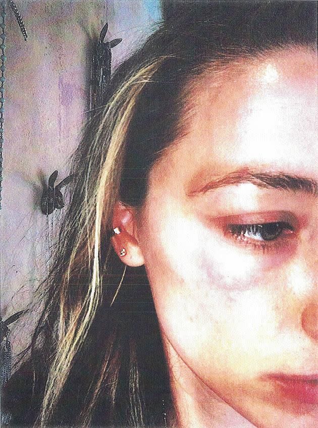 The actress says she was attacked by an iPhone by her husband Johnny Depp. Photo: Splash News