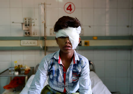 A boy who was was injured after a commuter train traveling at high speed ran through a crowd of people on the rail tracks on Friday, sits in a hospital bed in Amritsar, India, October 20, 2018. REUTERS/Adnan Abidi