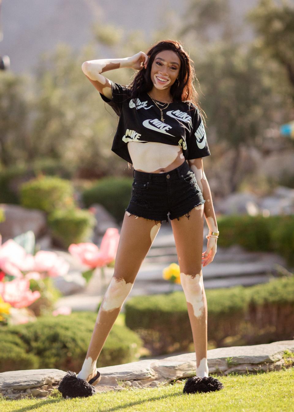 To go with her perfect sporty crop top and shorts combo, model Winnie Harlow rocked a pair of Ugg black Cindi sandals and a simple chain necklace.