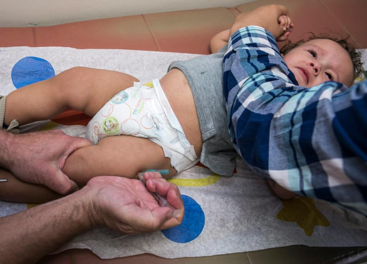 Measles symptoms include red rash, fever, cough, runny nose, red eyes and fatigue, and may start around 10 days after exposure but can appear anywhere from seven to 21 days later.  (Damian Dovarganes/The Associated Press - image credit)