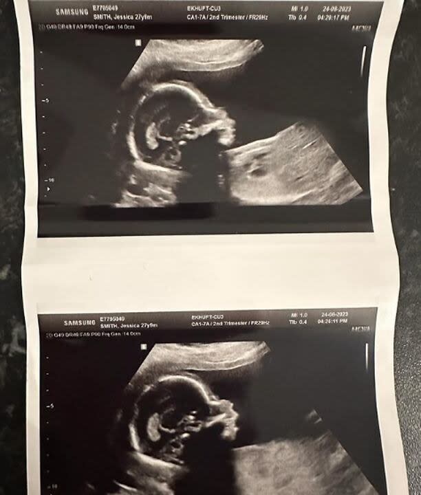 Jess Smith, la intérprete de Baby Sun, anunció que espera su primer hijo (Foto: Instagram)