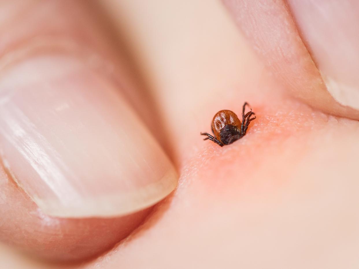 A close-up of tick attached to a person's body. Fingers touch the skin on either side of the tick