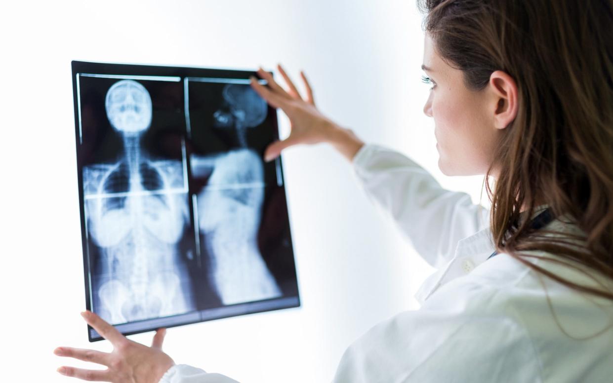 Doctor examines an x-ray - Getty