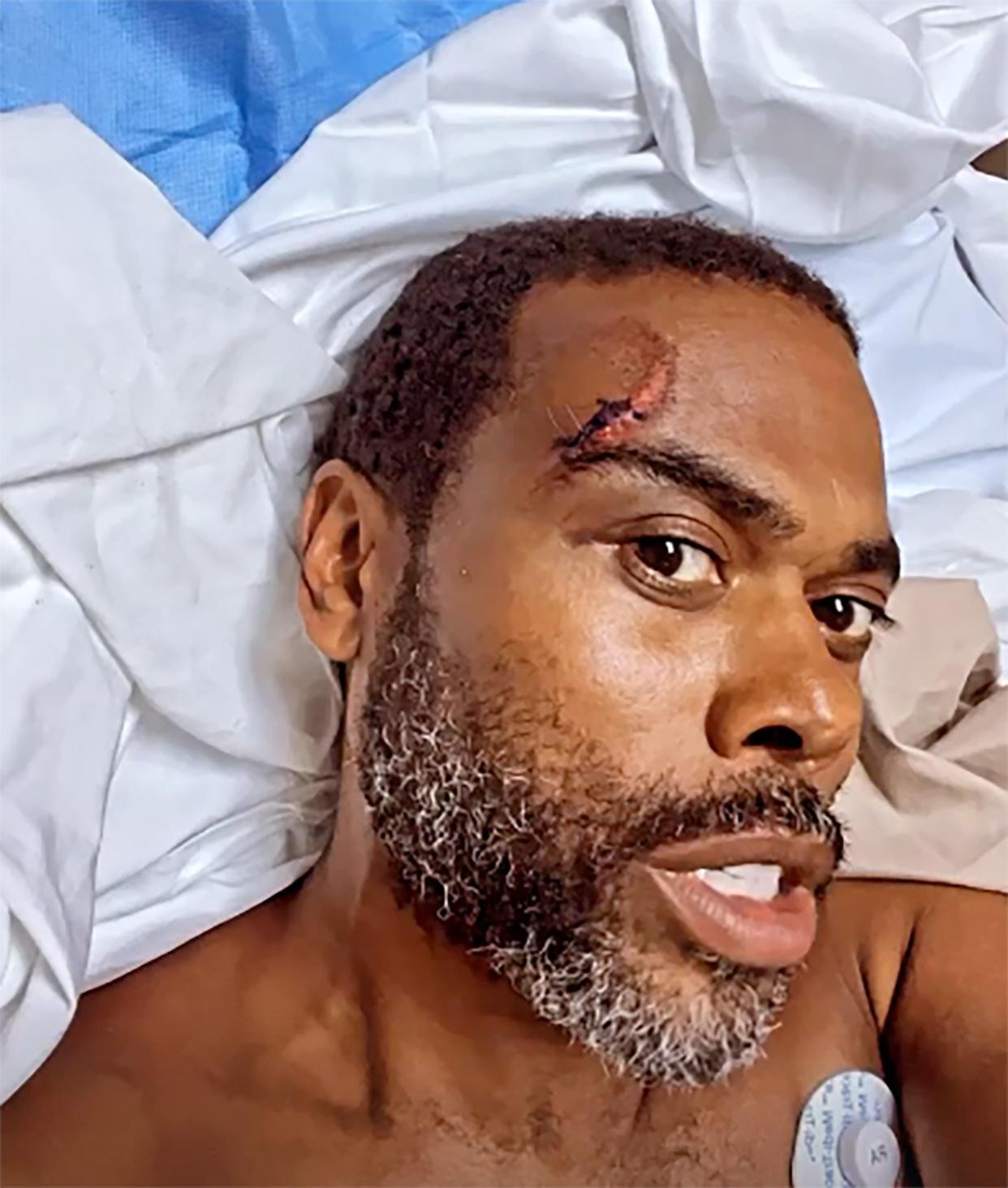 Comedian Lil Duval Reveals He Was Hit by a Car