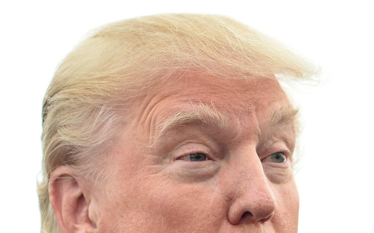 What is Donald Trump going through in order to retain his golden locks? - 2015 Getty Images