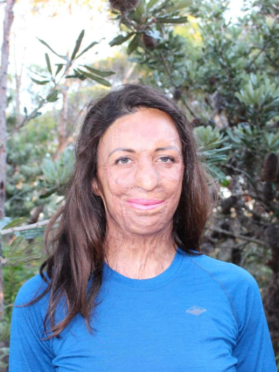 Turia made headlines in 2011 when she survived horrific burns during a race. Source: Instagram/turiapitt