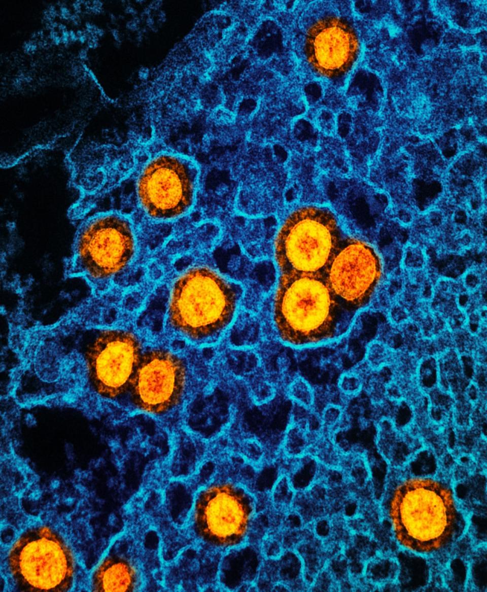 Transmission electron micrograph of SARS-CoV-2 Omicron virus particles replicating inside an infected cell. Around the world, scientists are striving to parse out just how risky a COVID-19 infection is at this point in time.