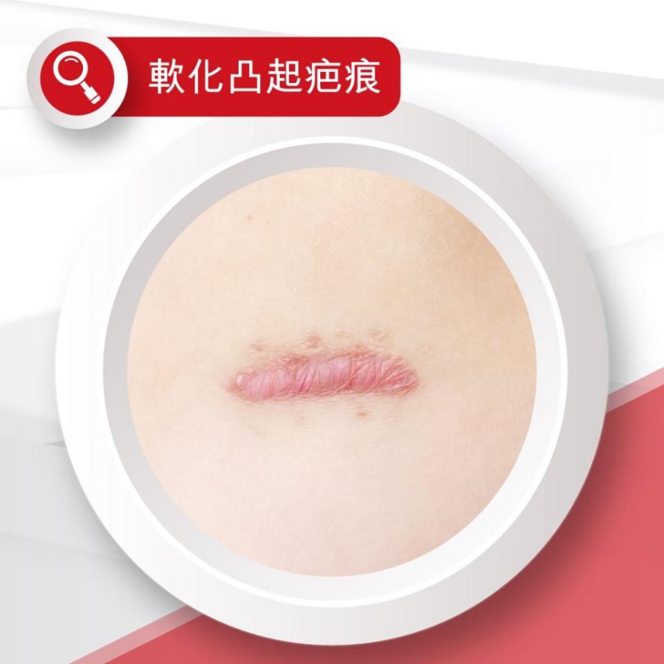 圖片來源：Elastoplast官方facebook