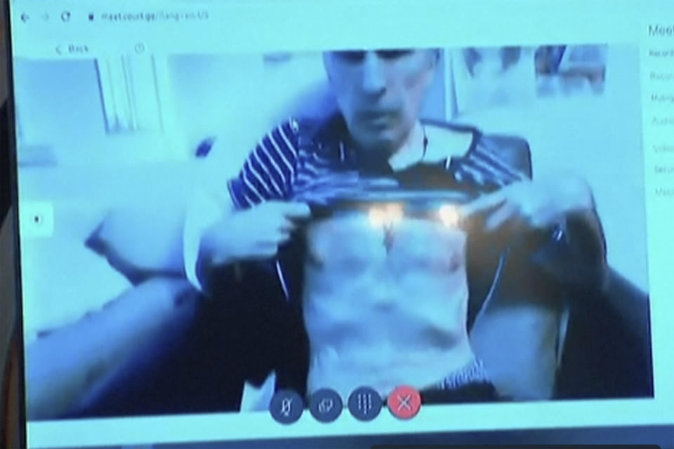 In this image made from video, Georgia’s imprisoned former president Mikheil Saakashvili attends a court hearing from hospital via video link in Tbilisi, Monday, July 3, 2023. Saakashvili appeared severely emaciated on Monday in videolink testimony to a court considering an abuse-of-power case against him. He and his supporters claim he was poisoned in prison and has lost half of his body weight since he was arrested in October 2021. (Pool Photo via AP)