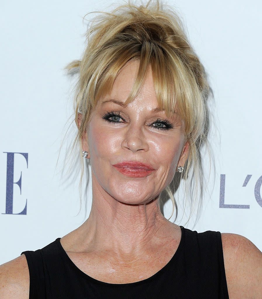 Melanie Griffith: Epilepsy