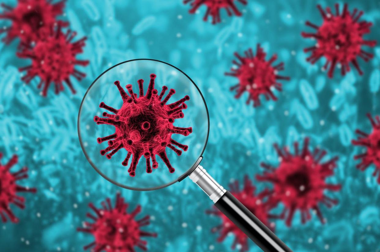 <span class="caption">Broad and frequent screening could catch coronavirus cases before they can spread to others</span> <span class="attribution"><a class="link " href="https://www.gettyimages.com/detail/photo/virus-epidemic-concept-biotechnology-research-royalty-free-image/1210724057?adppopup=true" rel="nofollow noopener" target="_blank" data-ylk="slk:Vaidas Bucys/EyeEm via Getty Images;elm:context_link;itc:0;sec:content-canvas"> Vaidas Bucys/EyeEm via Getty Images</a></span>