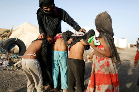 A woman shows skin disease on children at a camp for people displaced by the war near Sanaa, Yemen April 24, 2017. REUTERS/Khaled Abdullah