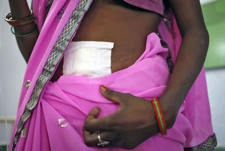 A woman, who underwent sterilization surgery at a government mass sterilization "camp", walks to sit in a hospital bed at a district hospital in Bilaspur, in the eastern Indian state of Chhattisgarh, India. REUTERS/Anindito Mukherjee