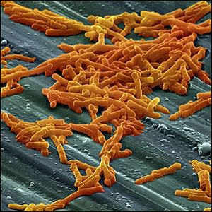 Spores of Clostridium difficile, a bacteria that can cause intestinal disease and in some cases death.