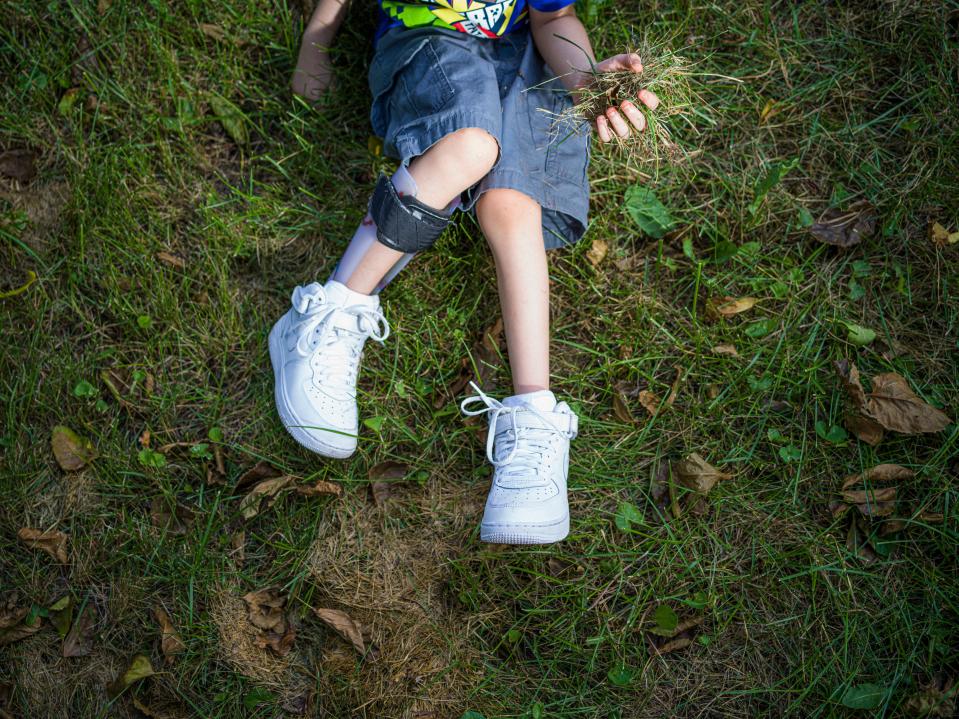 Clareon Williams rips a patch of grass from his backyard with his left hand, his only functioning hand after he was shot in the head. He is less then a year into his recovery.