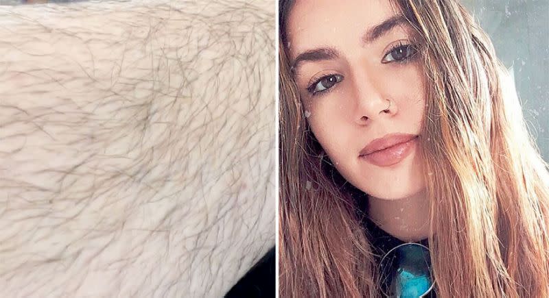 Ana Calatayud Perez-Manglano a arrêté de se raser les jambes en novembre [Photo: Caters]