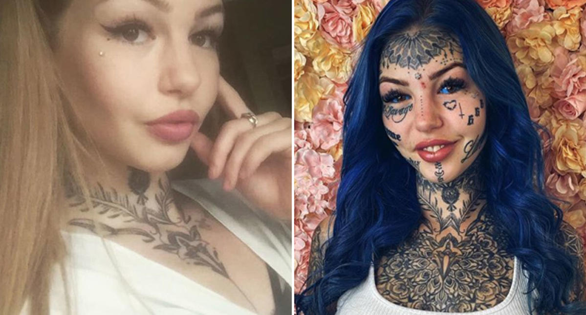 Nsw Woman Amber Luke Goes Blind After Tattooing Eyes Blue 