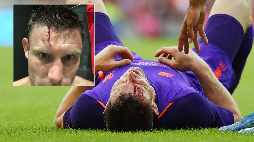 James Milner needed 15 stitches in a gruesome head wound.