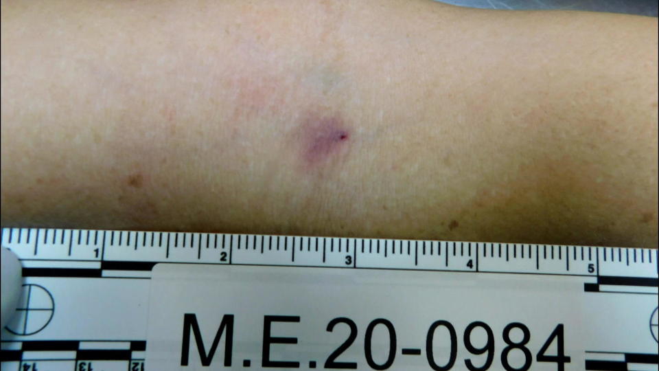 What investigators found particularly suspicious was a pinprick mark on Maria Muñoz's right elbow crease, the type someone would get after getting an IV.  / Credit: Webb County District Attorney's Office