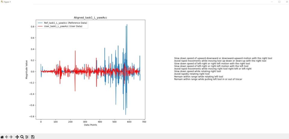 The simulator can provide feedback in visual, graph form. The red line indicates the trainee's movements and the blue line indicates the expert's movements.