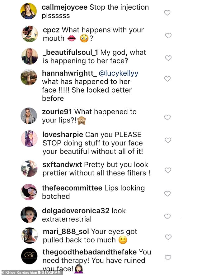 'What happened to your lips?' Her fans couldn't get over the distracting size of her lips as they rushed to comment on the reality star's post