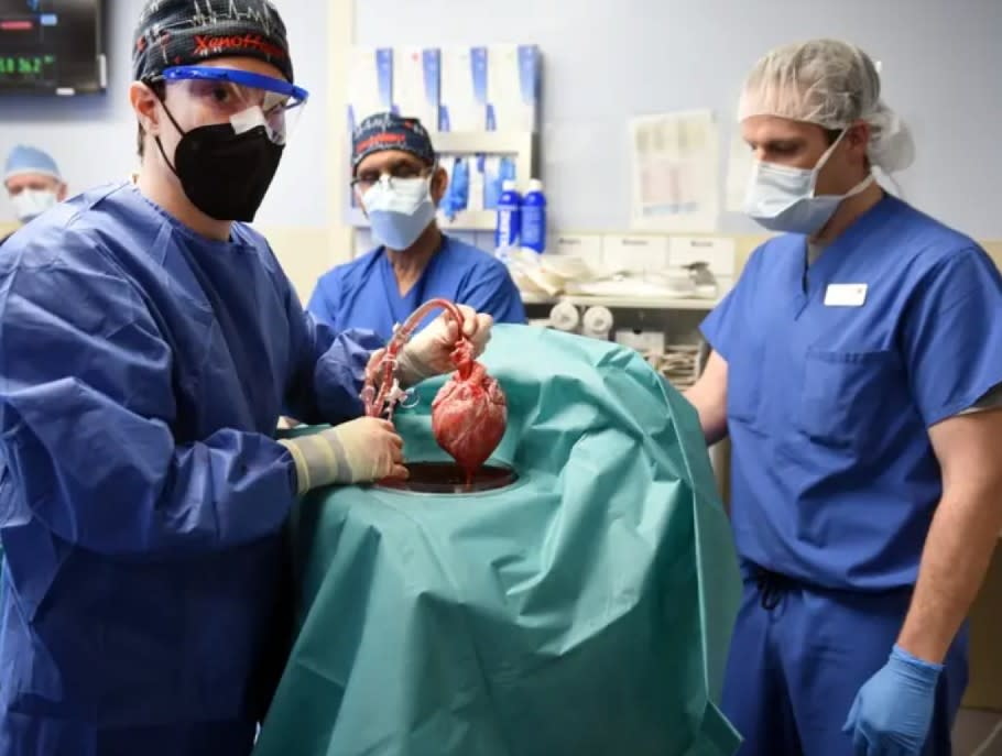 A historic transplant at University of Maryland Medicine showed for the first time that a genetically modified animal heart can function like a human heart without immediate rejection by the body, offering hope to other people with failing organs, doctors said. (Photo courtesy of University of Maryland Medicine)