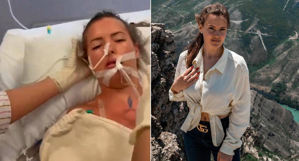 Instagram influencer Polina Strelets in hospital after the jet ski accident.