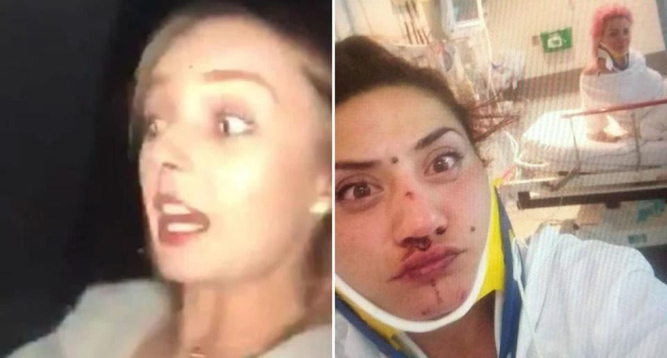 Shania McNeill (left) was filmed driving on Snapchat, just before she was killed in a head-on crash. Her friends Hazel Wildman and Faeda Hunter take a selfie from hospital.