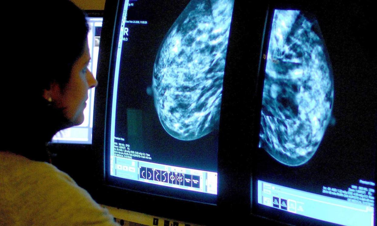 <span>A consultant analysing a mammogram. It is hoped the new AI tool will allow patients to get more individualised care. </span><span>Photograph: Rui Vieira/PA</span>