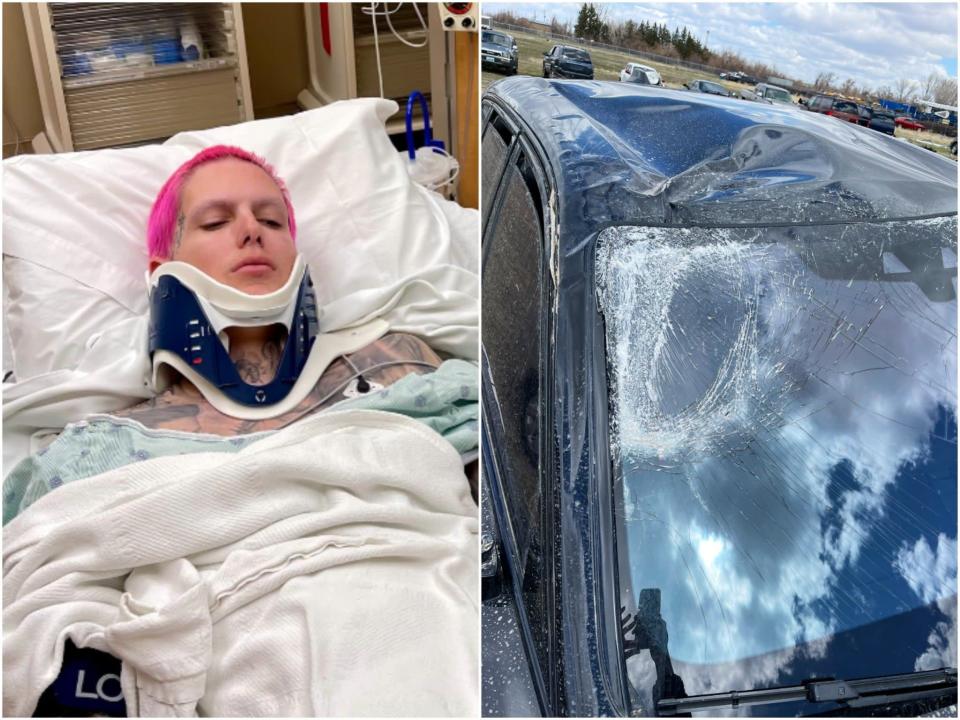 Star has now been discharged from hospital after the crash (Jeffree Star/Twitter)