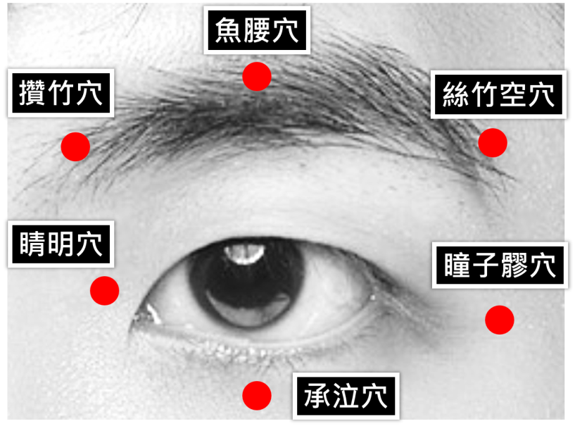 中醫眼周穴位按摩。圖/台北市立聯合醫院提供。