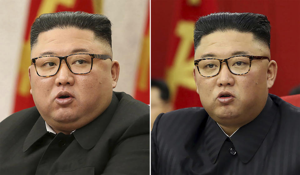 This combination of file photos provided by the North Korean government, shows North Korean leader Kim Jong Un's slimmer appearance. Source: AP