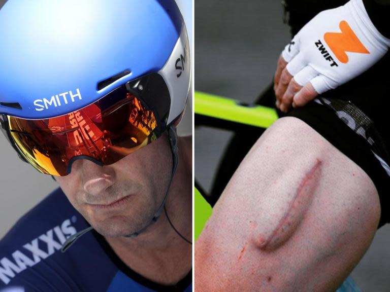 The former Team Sky cyclist Greg Henderson has revealed a bizarre image of the ”new quad muscle” which has developed on his left leg following surgery. Henderson underwent an operation in January while working at the Tour Down Under in Australia, in order to drain 500ml of pus from his thigh after an 18cm tear. “After 4wks of suffering and not being able to weight bare I finally made it to hospital to have 500ml of puss drained and my left quad muscle cleaned and drained,” he wrote at the time. ”One last operation now to drain and clean some more and sew it back up.”This week, following a full recovery from successful surgery, the New Zealander posted a picture on his Instagram of the healed part of his leg where a new muscle appears to have grown.“Basically brand new. Who doesn’t believe in evolution! I have evolved a new quad muscle. Ahhhh...quin muscle? marginalgains,” Henderson wrote. > View this post on Instagram> > Basically brand new. Who doesn’t believe in evolution! I have evolved a new quad muscle. Ahhhh...quin muscle? marginalgains Can anyone tell me what has happened here? I’d actually love to know exactly.> > A post shared by Greg Henderson (@greghendersonnzl) on May 15, 2019 at 1:13pm PDTHe added: “Can anyone tell me what has happened here? I’d actually love to know exactly.”Henderson, a UCI track world championship gold medallist in the scratch race and a 2002 Commonwealth champion, rode for Team Sky between 2010-11, and now works for USA Cycling.