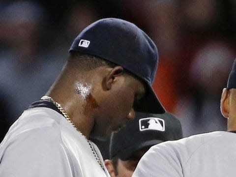 Michael Pineda's pine-tar fracas shows sticky stuff not a real concern for  MLB - Sports Illustrated