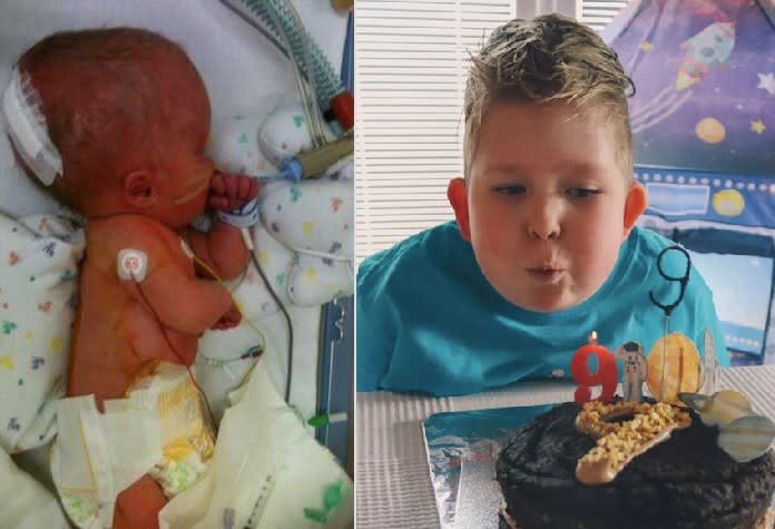 Noah Wall developed a rare brain condition in the womb and his parents were told by doctors that he would likely never talk, walk, or eat on his own. (SWNS)