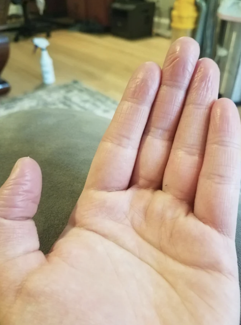 Close-up of a person's left hand with slightly wrinkled fingers