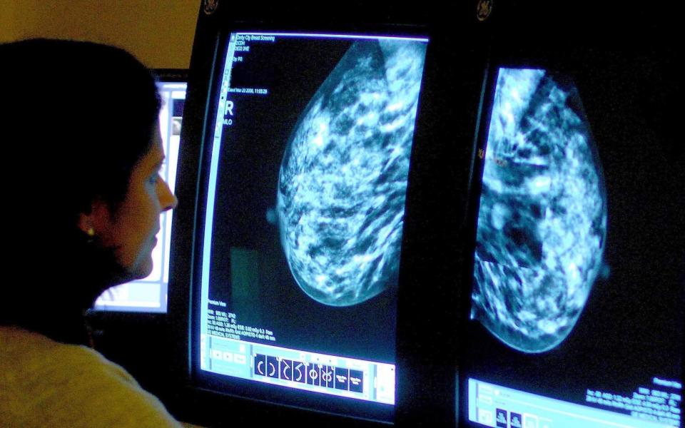 A consultant analysing a mammogram. Women with breast cancer are known to be at a greater risk of developing mental health conditions such as anxiety or depression - Rui Vieira/PA