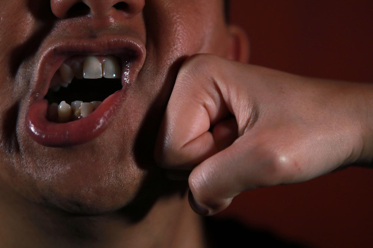 Man with face being punched