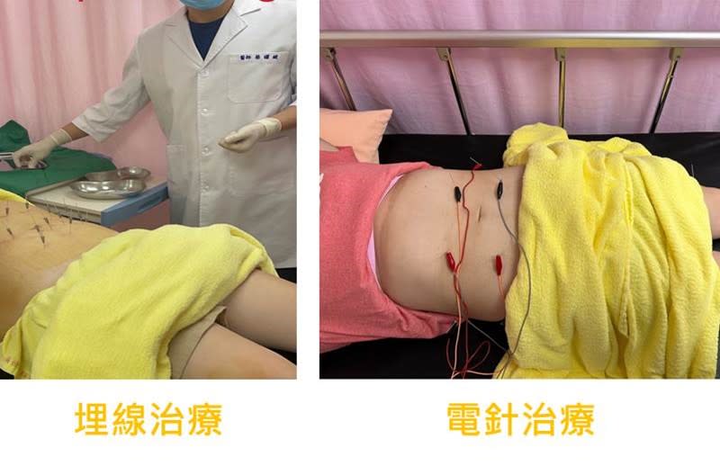 蔡曜鍵醫師分享中醫減重療法。台北市立聯合醫院提供。