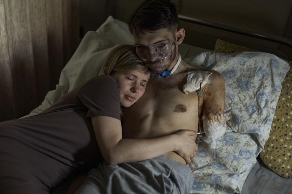 FILE - Alina, left, hugs her husband Andriy in a hospital in Kyiv, Ukraine, Monday, July 10, 2023. Andriy is a Ukrainian army 47th brigade air reconnaissance officer, code name Apostle, who was heavily wounded in a battle with Russian troops in the Zaporizhzhia region. (AP Photo/Libkos, File)