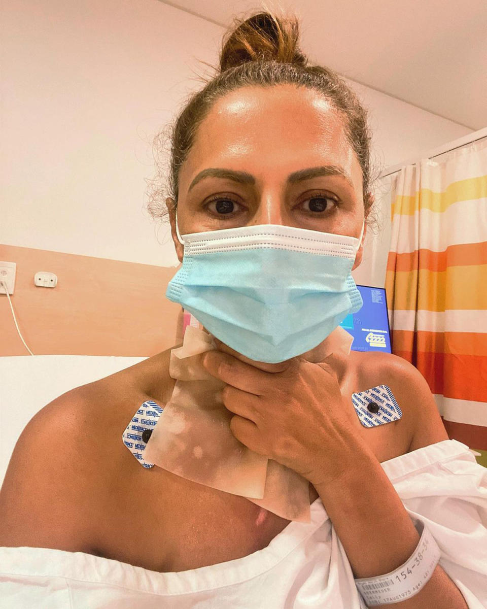 Sally Obermeder wearing a hospital gown and face mask while holding a towel over the burned skin on her neck.